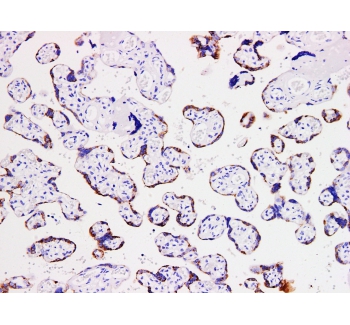hCG beta Antibody
