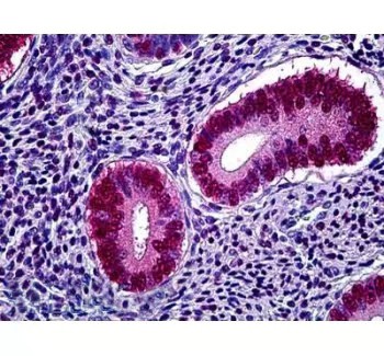 Anti-17OH Progesterone PAb