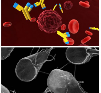 Giardia lamblia Monoclonal Antibody