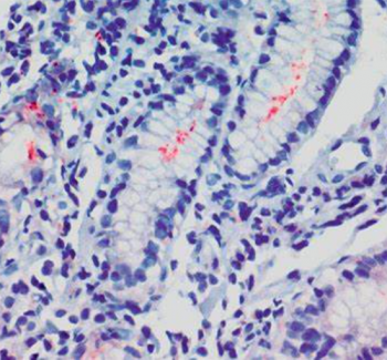 Anti-H.pylori Mab (clone P2) (x1mg)