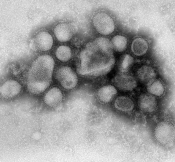 Influenza A (H1N1) Panel