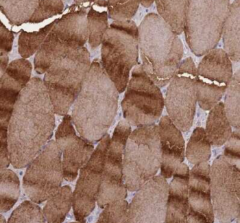 CKMM antibody (70-XG47)