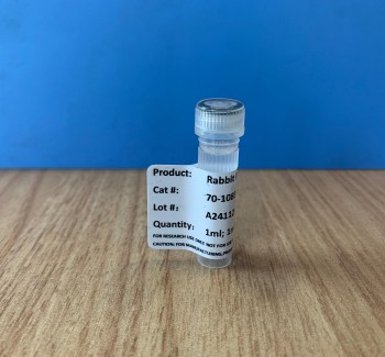 Rabbit Polyclonal PSA antibody,70-1083