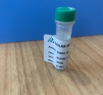 Rabbit anti Human lgE epsilon, affinity pure