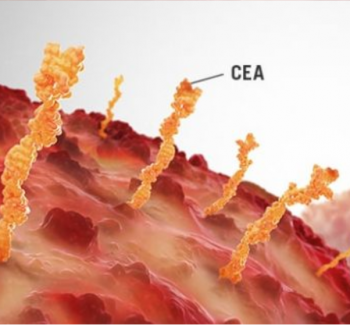 CEA protein(30-AC25)