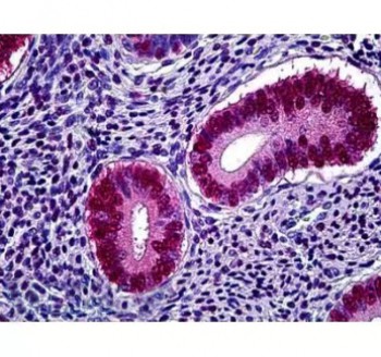 Anti-17OH Progesterone PAb